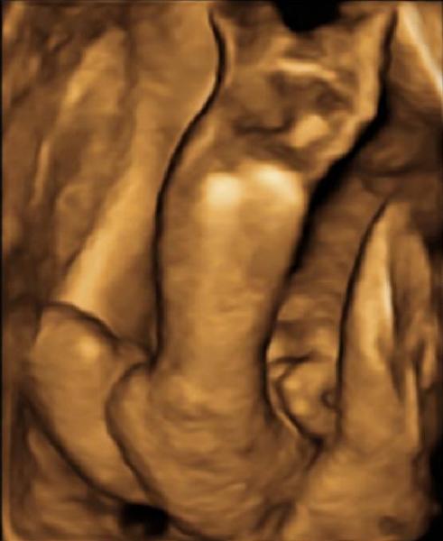 foto n. 2bis immagine eografia prenatale