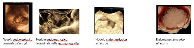 Ambulatorio Di Ecografia Di Ii Livello Irccs Materno Infantile Burlo Garofolo