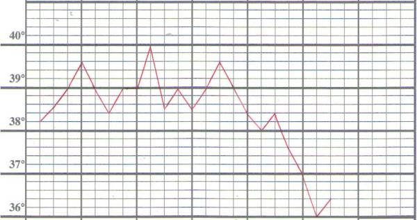 Andamento della temperatura durante una delle crisi febbrili